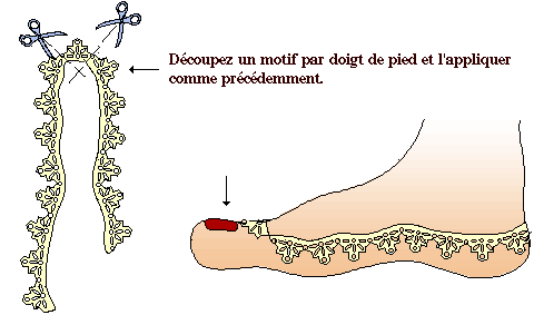 gif animé montrant les positions des pochoirs sur les pieds ainsi que la mise de la pâte gif animé montrant les positions des pochoirs sur les pieds ainsi que la mise de la pâte